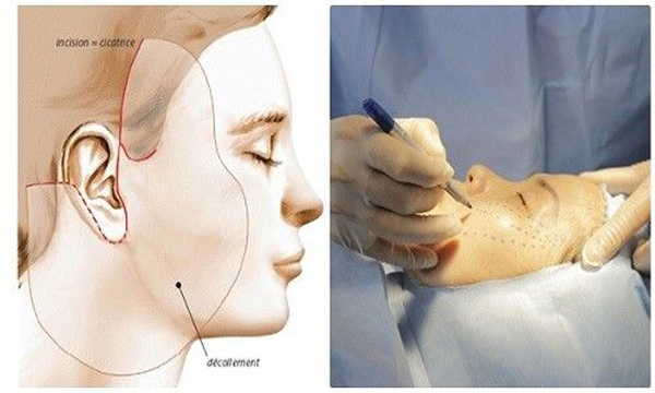 Đi tìm 10 loại hình phẫu thuật thẩm mỹ được ưa chuộng nhất hiện nay