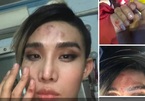Bị tố đánh người mẫu trên phố Sài Gòn, tài xế Go Việt nói lý do