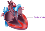 Triệu chứng dễ bỏ qua khiến 2 phụ nữ Hà Nội tử vong do viêm cơ tim