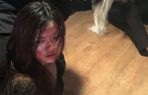 Lương Thanh để lộ cái kết bi thảm của Trà 'Hoa hồng trên ngực trái'