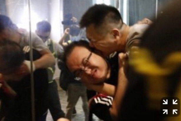 Nghị sĩ Hong Kong bị tấn công, cắn đứt tai giữa cuộc biểu tình