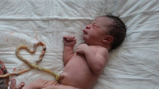 Trẻ sơ sinh tử vong sau 10 tiếng sinh tại nhà