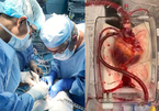 Bác sĩ hồi sinh được trái tim người chết, mở ra đột phá y học trong ghép tạng