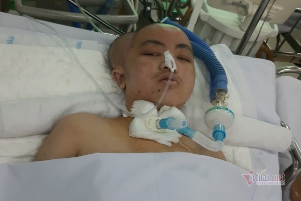 Bé 13 tuổi bị chấn thương sọ não, cha mẹ nghèo hết tiền phẫu thuật ghép sọ cho con