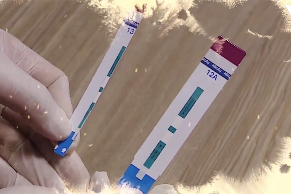 Vụ cắt đôi que thử HIV ở BV Xanh Pôn: Sẽ điều tra nếu có dấu hiệu hình sự