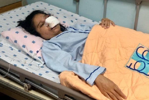 Cô giáo mang thai phải trải qua 3 cuộc phẫu thuật nạo khối u hiếm