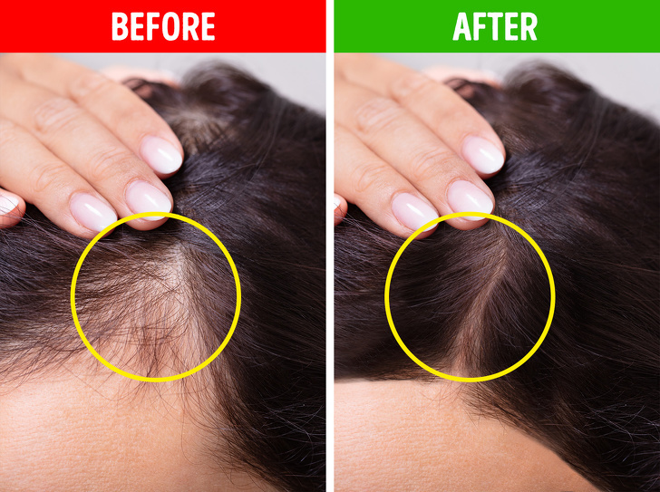 Nguyên nhân khiến tóc thưa Biện pháp chữa tóc thưa hiệu quả
