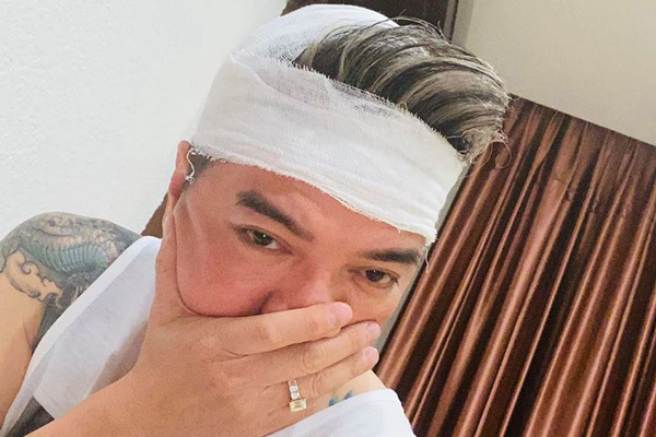 Đàm Vĩnh Hưng gặp tai nạn chảy máu đầu trên sân khấu