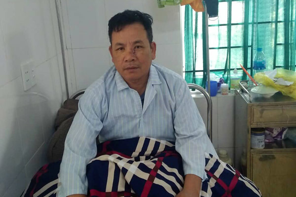 Truy đuổi trộm chó, trưởng công an xã bị ném gãy mũi