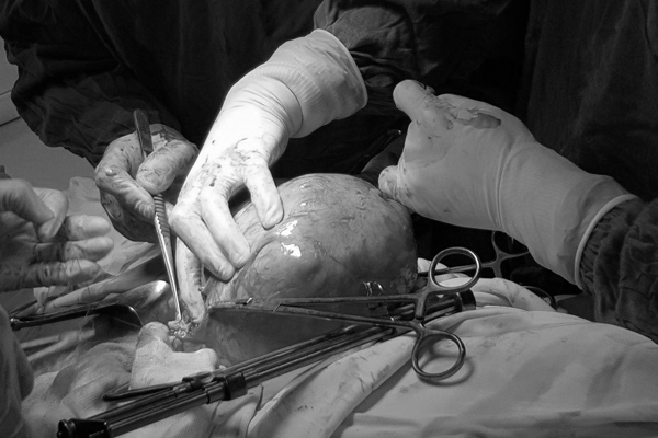 Tin uống thực phẩm chức năng, người phụ nữ Hà Nội suýt mất mạng