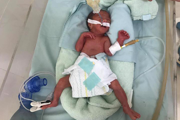 Không nhìn thấy đường, bác sĩ vượt 500km cứu bé sơ sinh nhỏ như cốc nước