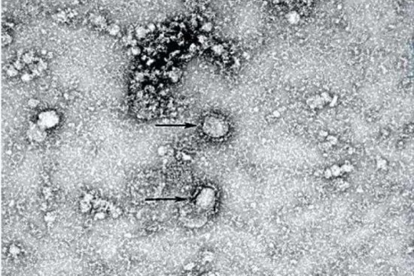 Trung Quốc công bố hình ảnh chính thức của virus corona