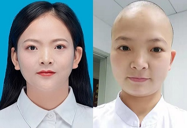 Nữ y tá ở 'tâm bão' Vũ Hán cạo trọc đầu để tránh lây nhiễm chéo virus corona