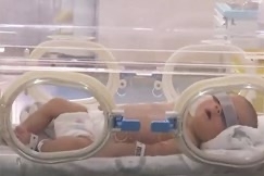 Hình ảnh các bệnh nhân nhí chiến đấu với virus corona