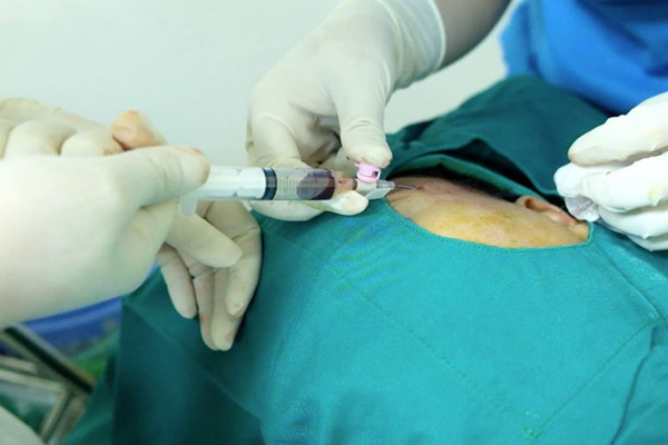 Độn thái dương làm đẹp, quý ông vào viện cấp cứu