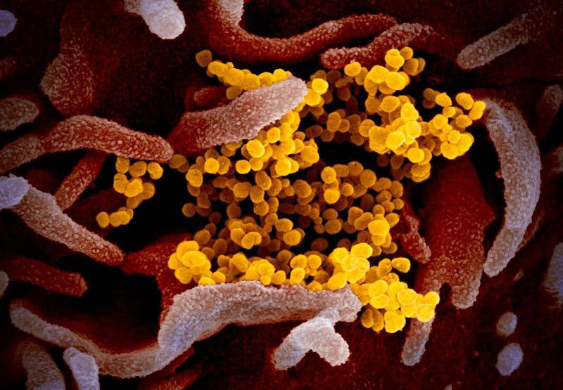 Hình ảnh virus Covid-19 len lỏi trong tế bào người