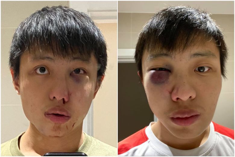 Du học sinh ở Anh tìm nhân chứng sau khi bị tấn công liên quan đến virus corona