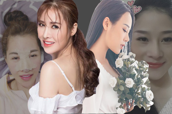 Sắc vóc 2 người đẹp Việt công khai sửa mũi 6 lần