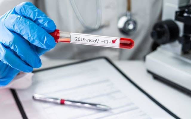 Việt Nam ghi nhận ca nhiễm Covid-19 thứ 31