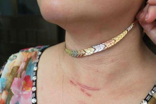 Người phụ nữ bán thịt heo quật ngã tên cướp trên phố Sài Gòn