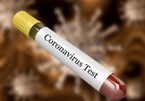 Coronavirus: US volunteers test first vaccine