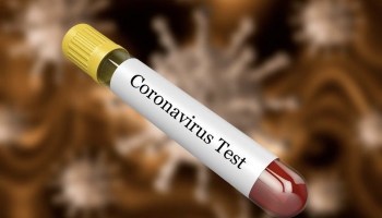 Coronavirus: US volunteers test first vaccine