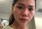 Vietnamese woman claims she was attacked in Australia for wearing a mask