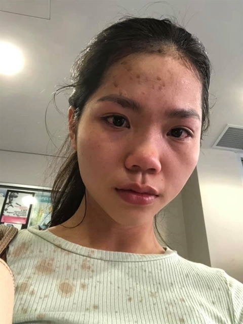 Vietnamese woman claims she was attacked in Australia for wearing a mask