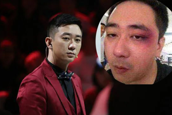 Tài tử Trung Quốc bị vợ đánh đập tàn nhẫn phải nhập viện