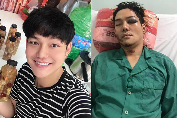 Tin mới về sức khoẻ con nuôi Hoài Linh sau vụ tai nạn nghiêm trọng