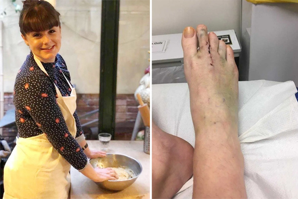 Cô gái không thể đi bộ quá 5 phút suốt 3 năm