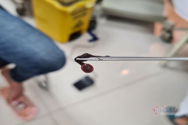 Rửa mặt ở suối rừng, người phụ nữ Quảng Bình bị đỉa chui vào mũi