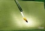 Gắp hạt thóc chui vào dương vật của bệnh nhân 33 tuổi