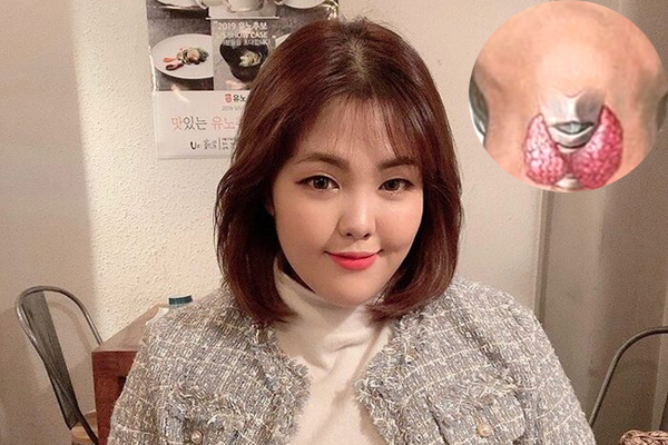 4 dấu hiệu nhận biết căn bệnh ung thư nữ blogger nổi tiếng mắc phải