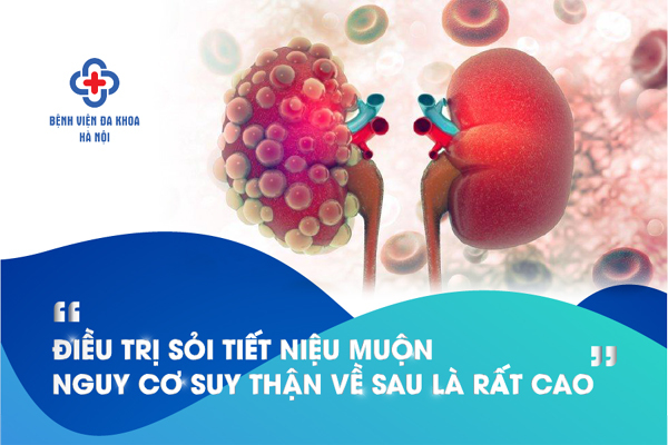 Cơ hội khám, sàng lọc sỏi tiết niệu miễn phí ở BV Đa khoa Hà Nội