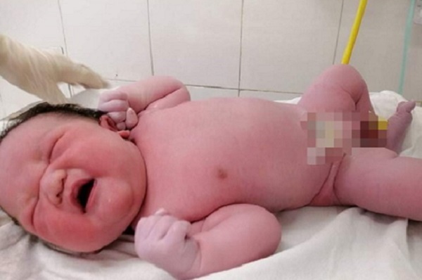 Bé sơ sinh nặng gần 5.4kg chào đời ở Hà Nội