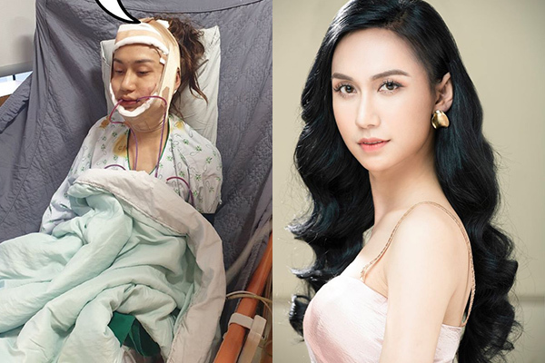Lynk Lee công khai hành trình chuyển giới