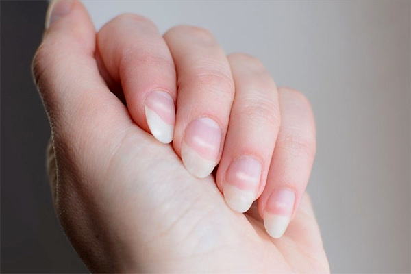 Bất thường trên móng tay tiết lộ sức khỏe của bạn