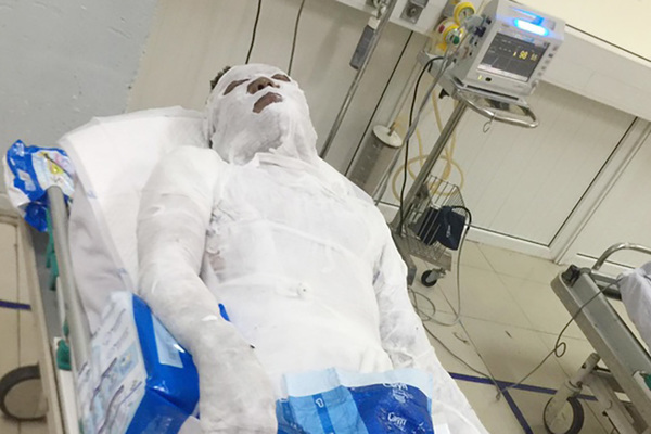 Tạm giữ đối tượng đổ xăng đốt cháy người đàn ông ở Nghệ An