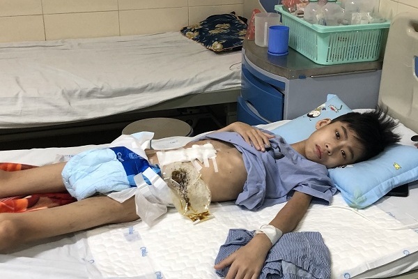Bị cắt ruột vì ung thư, nam sinh đau khổ không dám đi học