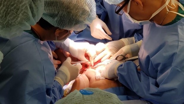 HCM City's doctors separate conjoined twins