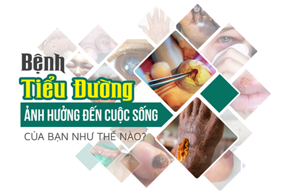 4 dấu hiệu quan trọng cảnh báo bệnh tiểu đường