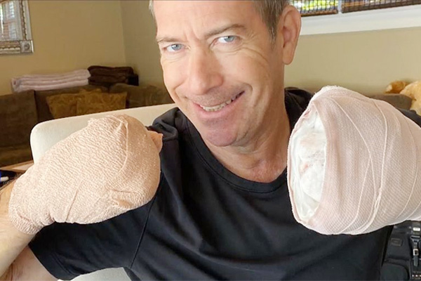 Bệnh nhân số 0 khỏi bệnh nhưng mất gần hết ngón tay ở Mỹ