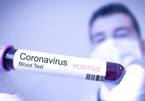 Tại sao nhiều bệnh nhân Covid-19 ít triệu chứng hơn so với người khác
