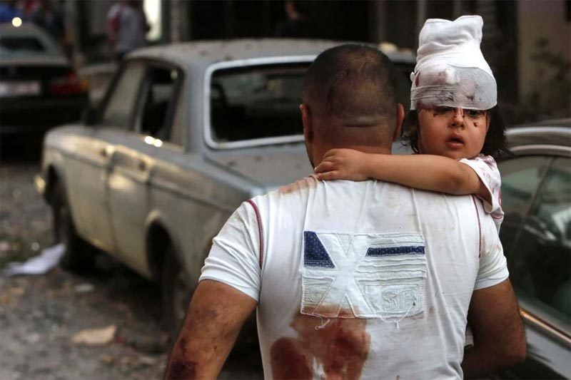 Thảm cảnh kinh hoàng sau vụ nổ rung chuyển thủ đô Lebanon