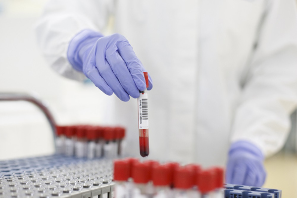 Roche hỗ trợ Y tế Việt Nam nâng cao năng lực xét nghiệm Covid-19