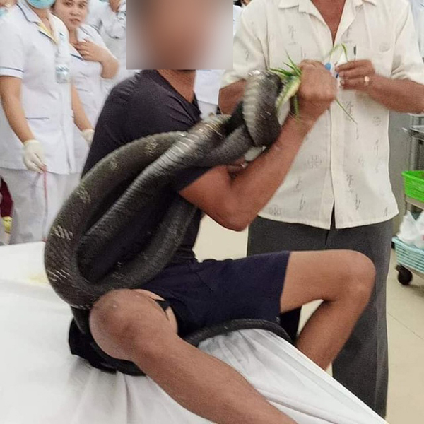 Bác sĩ ớn lạnh khi bệnh nhân mang rắn hổ mang dài gần 3m vào cấp cứu