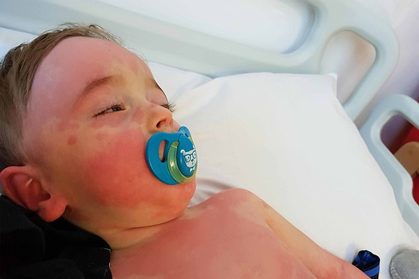 Căn bệnh lạ ở trẻ em liên quan tới virus nCoV