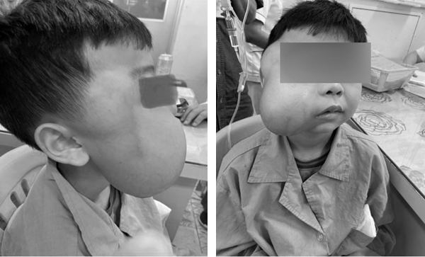 20 kiểu tóc Hàn Quốc cho bé trai nhiều phong cách cực đáng yêu