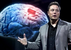 Tiết lộ cỗ máy cấy chip vào não người của Elon Musk
